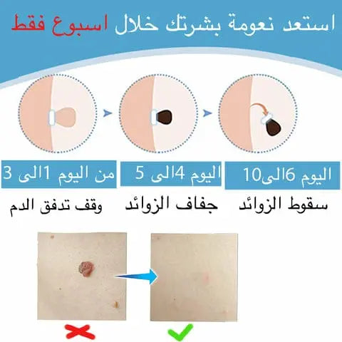 جهاز ازالة الثواليل بعددة رؤوس  أدوات صحية