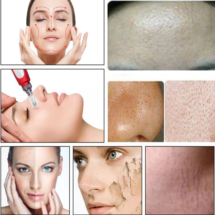 قلم ديرما الكهربائي من جويل للعناية بالبشرة Joelle MICRO NEEDLE THERAPY DERMA PEN  مستلزمات نسائية