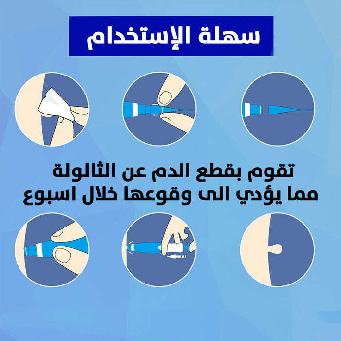 قلم إزالة الثالولة من الجسم والوجه tag removal kit  أدوات صحية