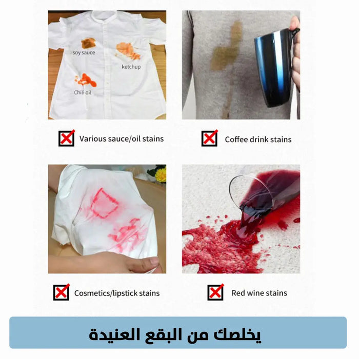 مزيل بقع الملابس Stain Remover Ball -  