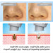 جهاز الهيدرافيشل المنزلي المميز ماركة فيتال الايطالية vital HydraFacial blackheads remover VIT-011  مستلزمات نسائية