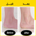 مزيل الجلد الميت مـن القدمين يعمل بالشحن Callus Remover for Feet  مستلزمات صحية