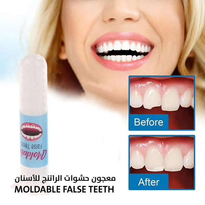 معجون حشوات الراتنج للأسنان Moldable False Teeth -  مستلزمات صحية