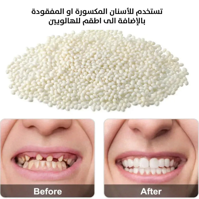 معجون حشوات الراتنج للأسنان Moldable False Teeth -  مستلزمات صحية