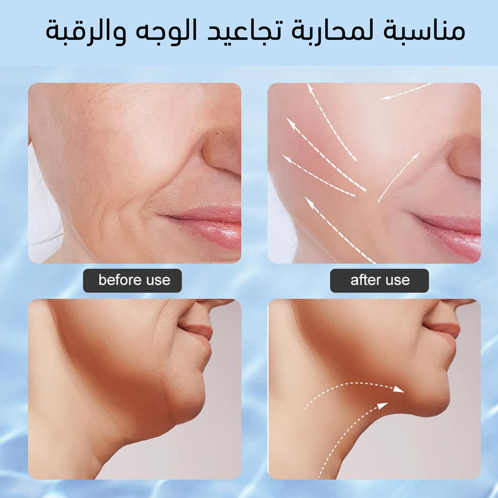 جهاز تقليل التجاعيد بالضوء النبضي للوجه والرقبة Intense Pulsed Light Wrinkles Reducing Instruments ES-108 1