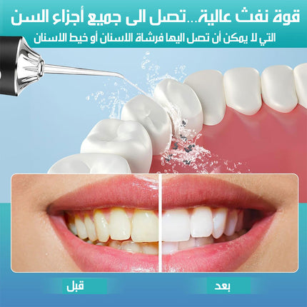 جهاز تنظيف الأسنان بقوة نفث الماء Water Teeth Flosser