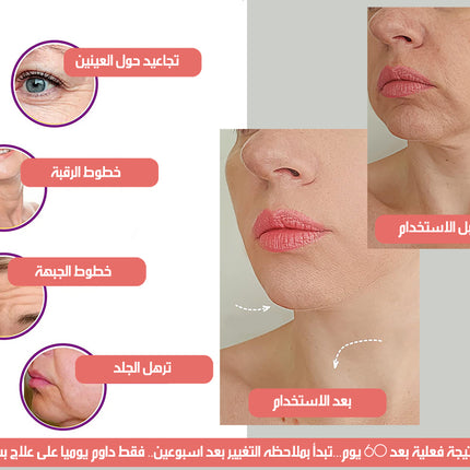 جهاز تقليل التجاعيد بتقنية الضوء النبضي المكثف INTENSE PULSED LIGHT WRINKLES REDUCING