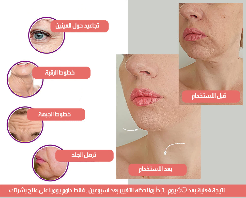 جهاز تقليل التجاعيد بتقنية الضوء النبضي المكثف INTENSE PULSED LIGHT WRINKLES REDUCING