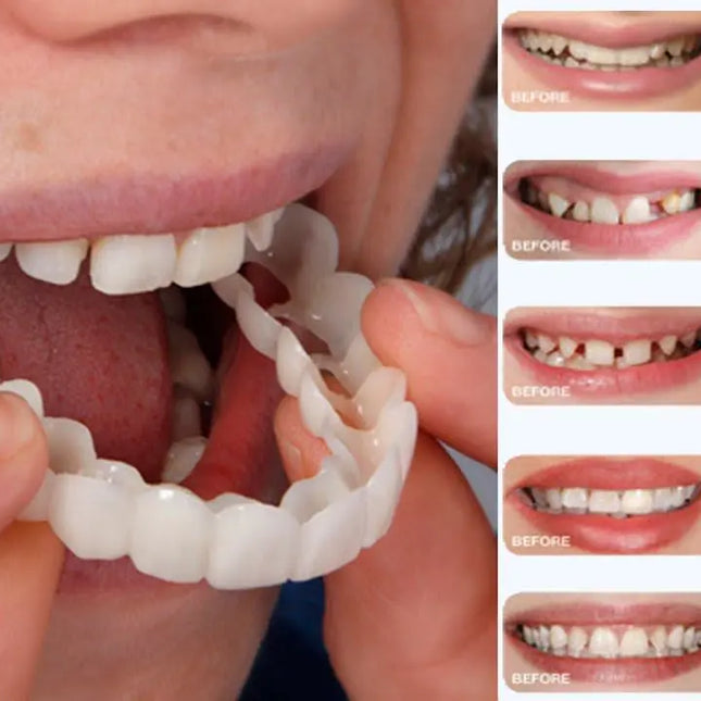 طقم اسنان متحرك