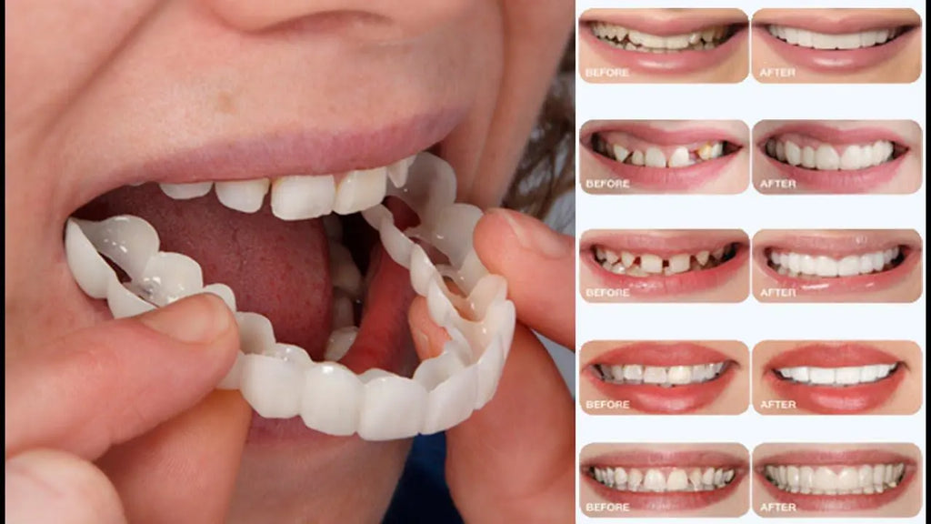 طقم اسنان متحرك