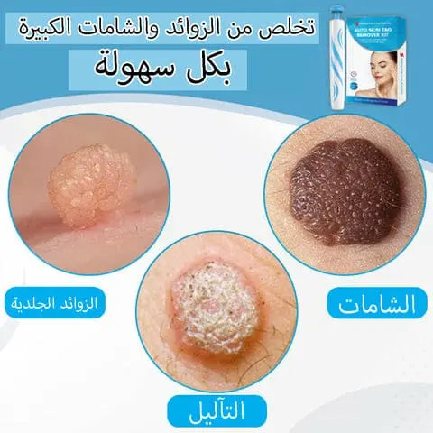 جهاز ازالة الثواليل بعددة رؤوس  أدوات صحية