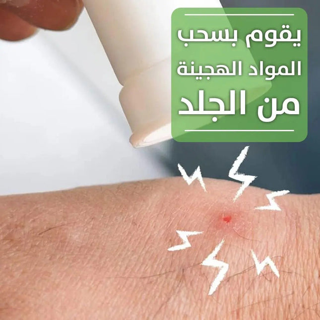 جهاز سحب سم الحشرات من الجلد 2812