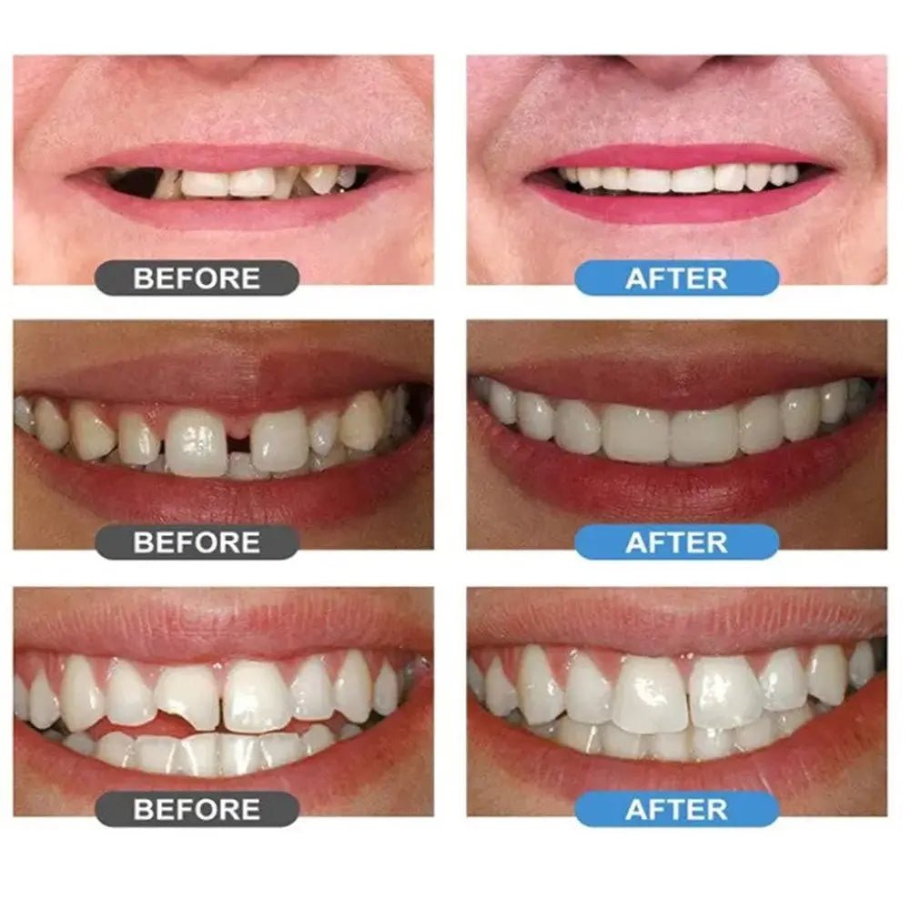 معجون حشوات الراتنج للأسنان moldable false teeth 3138