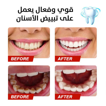 معجون تبيض الأسنان الفعال stain removal toothpaste 2756