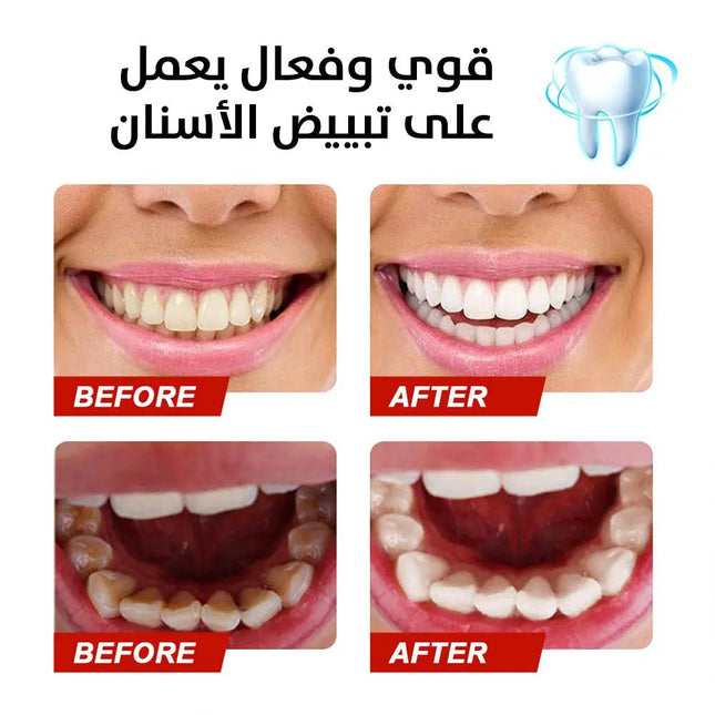 معجون تبيض الأسنان الفعال stain removal toothpaste 2756