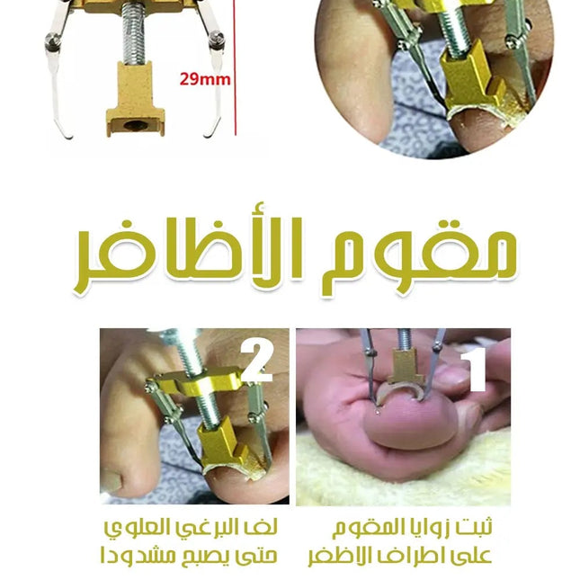 مقوم الأظافر Ingrown Toe Nail Fixer Device 411