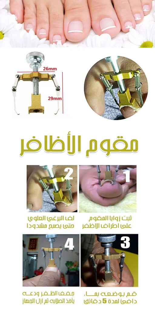 مقوم الأظافر Ingrown Toe Nail Fixer Device 411
