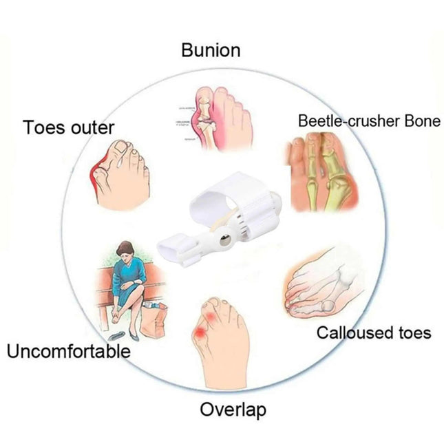 مصحح لأصابع القدم Bunion Corrector Relief Orthopedic Splint 1766