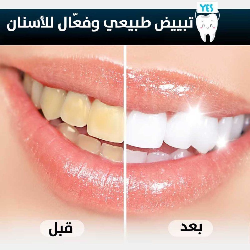 طقم العناية الذكي بالأسنان خيط مائي احترافي+فرشاة مبتكرة Smart Dental Care Kit Professional Water Flosser + Innovative Toothbrush 6100